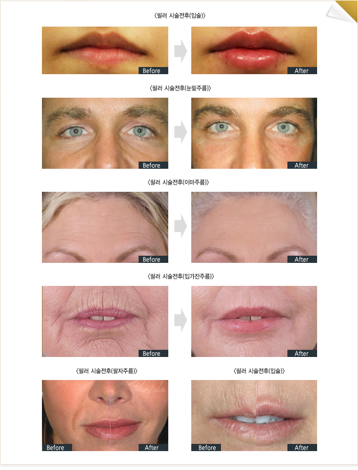 �ü�����