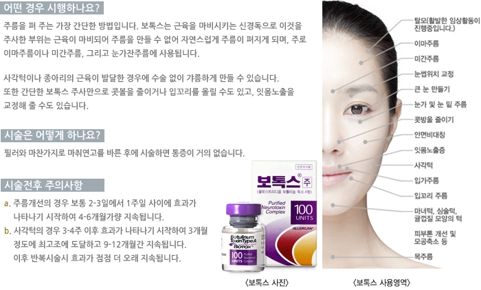 � ��� �����ϳ���?/�ü��� ��� �ϳ���? / �ü����� ���ǻ���