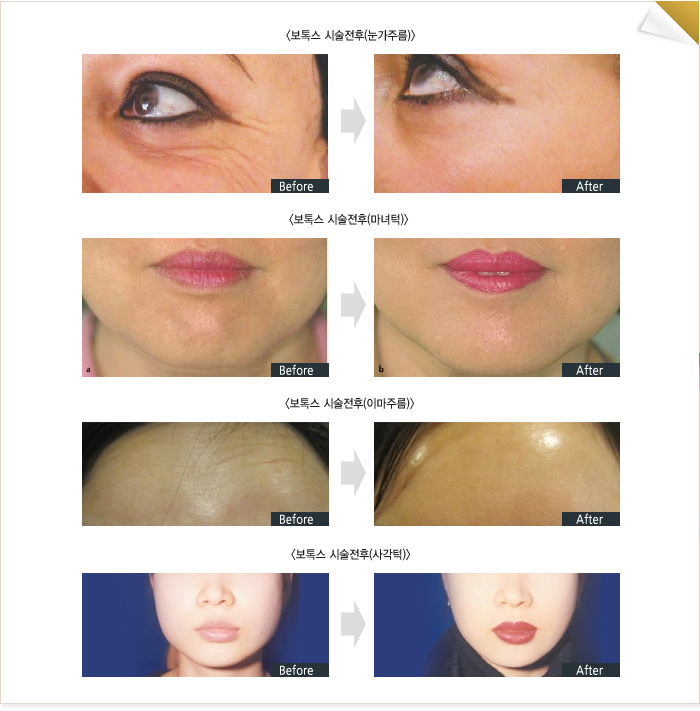 �ü�����