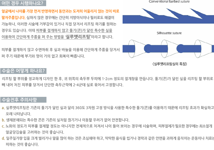 � ��� �����ϳ���?/������ ����ϳ���?/�������� ���ǻ���