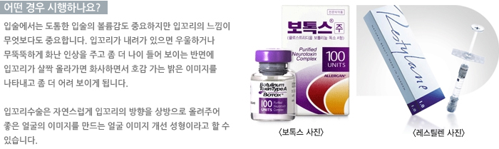 � ��� �����ϳ���?