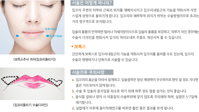 �ü��� ����ϳ���?/�ü����� ���ǻ���