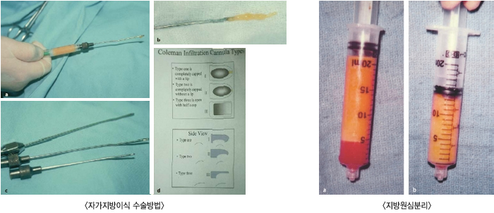 �ڰ������̽� �������/������ɺи�