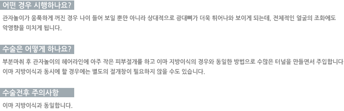 ���� �����ϳ���? / ������ ��� �ϳ���? / �������� ���ǻ���