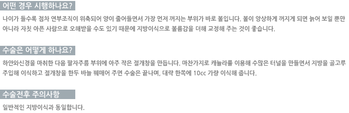 ���� �����ϳ���? / ������ ��� �ϳ���? / �������� ���ǻ���