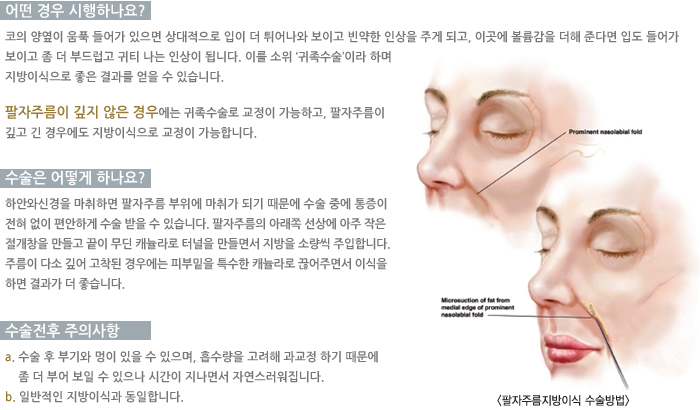 ���� �����ϳ���? / ������ ��� �ϳ���? / �������� ���ǻ���