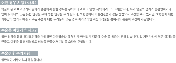 ���� �����ϳ���? / ������ ��� �ϳ���? / �������� ���ǻ���