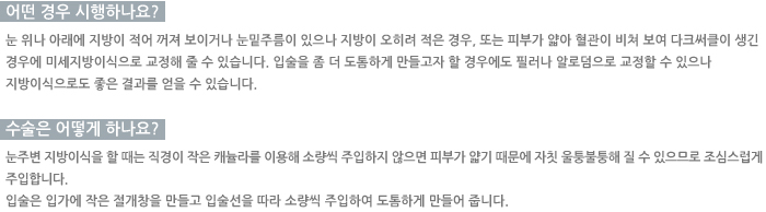 ���� �����ϳ���? / ������ ��� �ϳ���? / �������� ���ǻ���