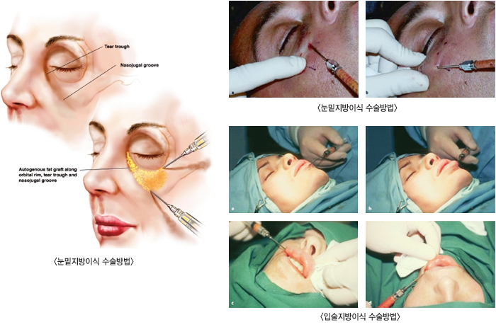 ���������̽� ������� / �Լ������̽� �������