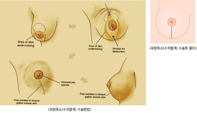 �������(��������)�������, ����������