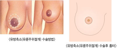 �������(������������)�������, ����������