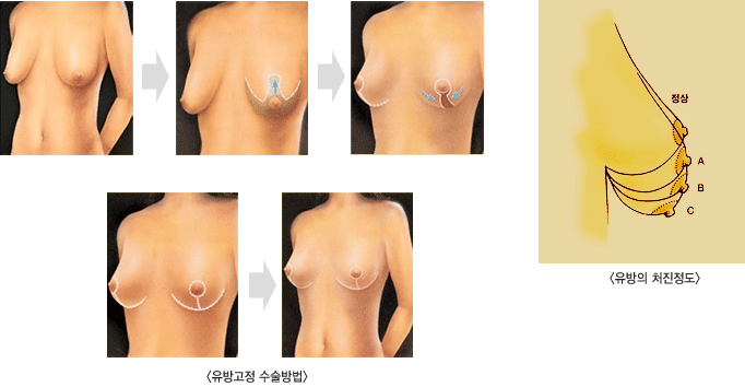 ������� �������, ����ó������