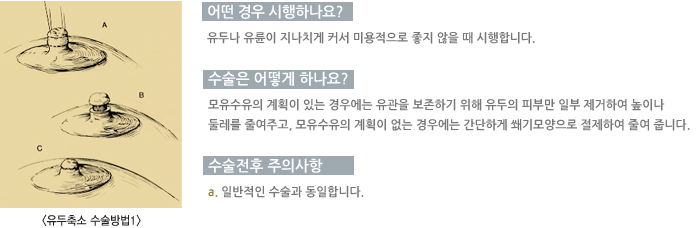 � ��� �����ϳ���?/������ ��� �ϳ���? /�������� ���ǻ���