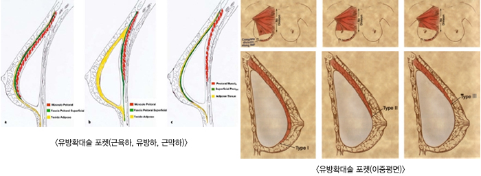 ����Ȯ������(������, ������, �ٸ���)/����Ȯ������(�������)