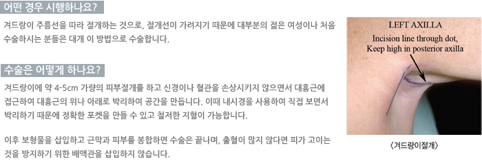 � ��� �����ϳ���?/������ ��� �ϳ���?/�ܵ���� ����