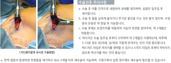 �ܵ�������� ���ð� �������/�������� ���ǻ���