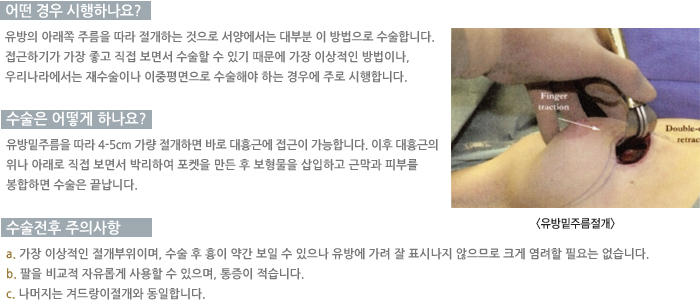 � ��� �����ϳ���?/������ ��� �ϳ���?/�������� ���ǻ���/�ܵ���� ����