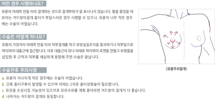 � ��� �����ϳ���?/������ ��� �ϳ���?/�������� ���ǻ���/�ܵ���� ����