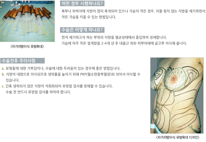 � ��� �����ϳ���?/������ ��� �ϳ���?/�������� ���ǻ���/�ܵ���� ����